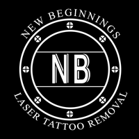 New Beginnings Laser Tattoo Removal